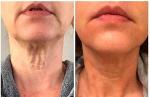 WhatsApp Image 2020 11 15 at 11.57.40