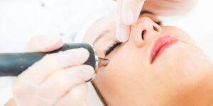 Co2 بهتره یا RF ؟ کدام روش درمانی موثر تر است؟! 11 Co2 بهتره یا RF 2