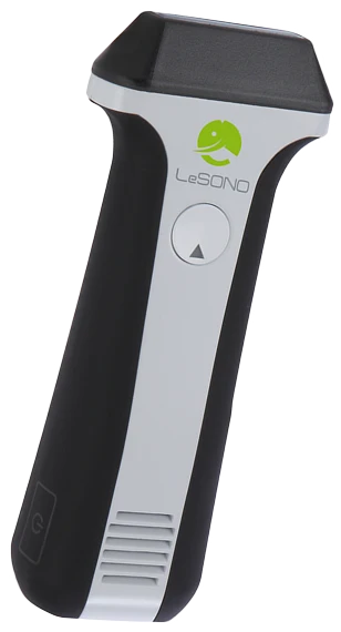 دستگاه سونوگرافی لسونو