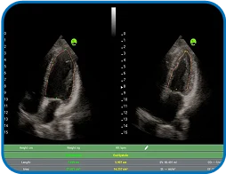 حالت های تصویربرداری متنوع لسونو