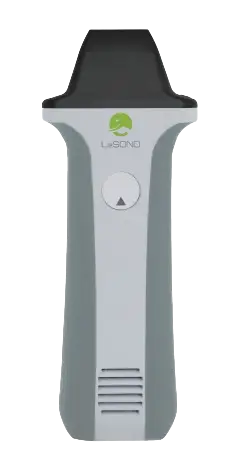 معرفی دستگاه سونوگرافی دستی 11 دستگاه سونوگرافی دستی چیست؟