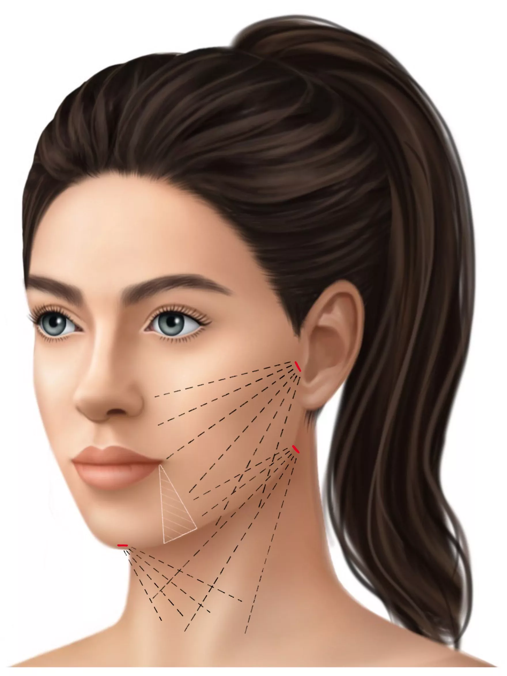 اندولیفت برای چه سنی مناسب است