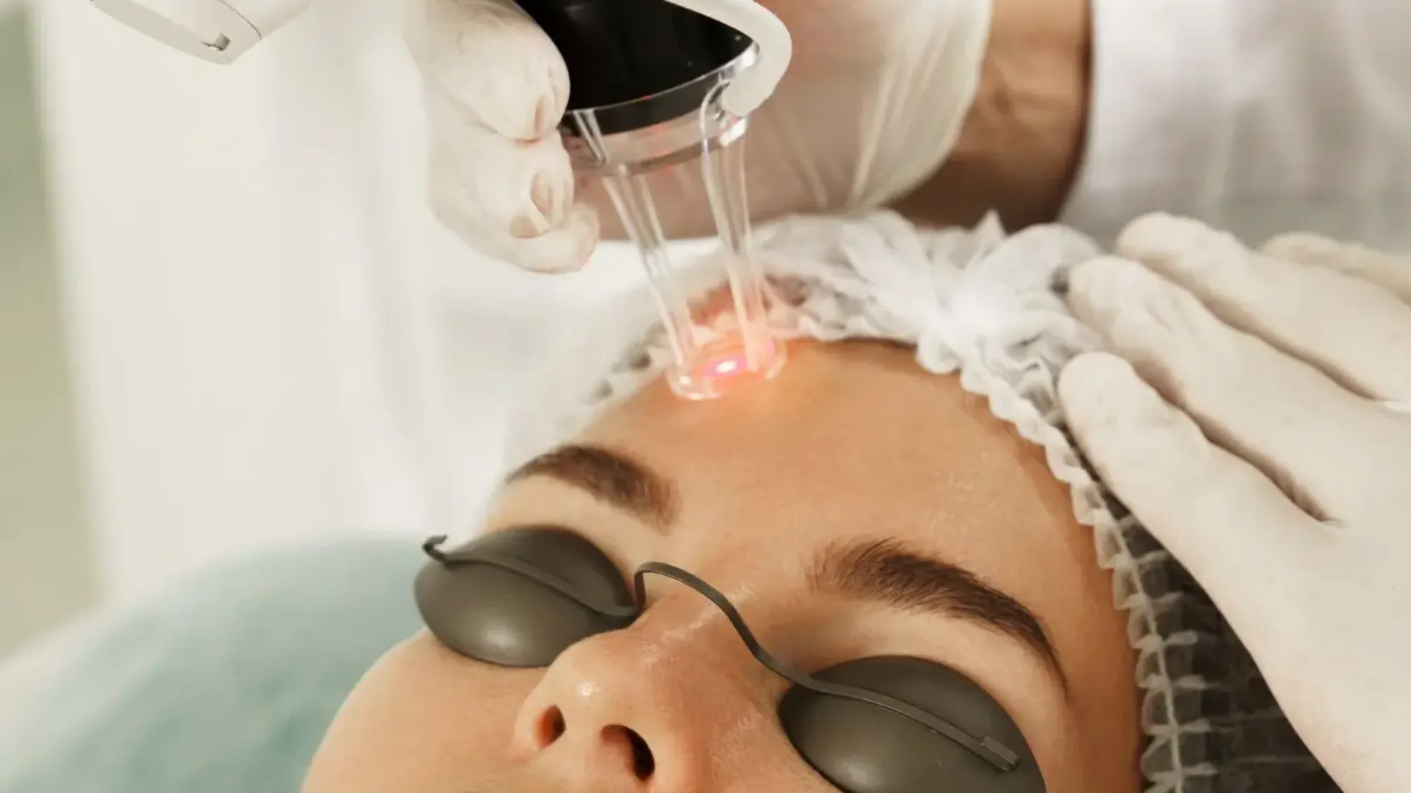 5. کسانی که به دنبال درمان لک‌های مقاوم و ملاسما هستند