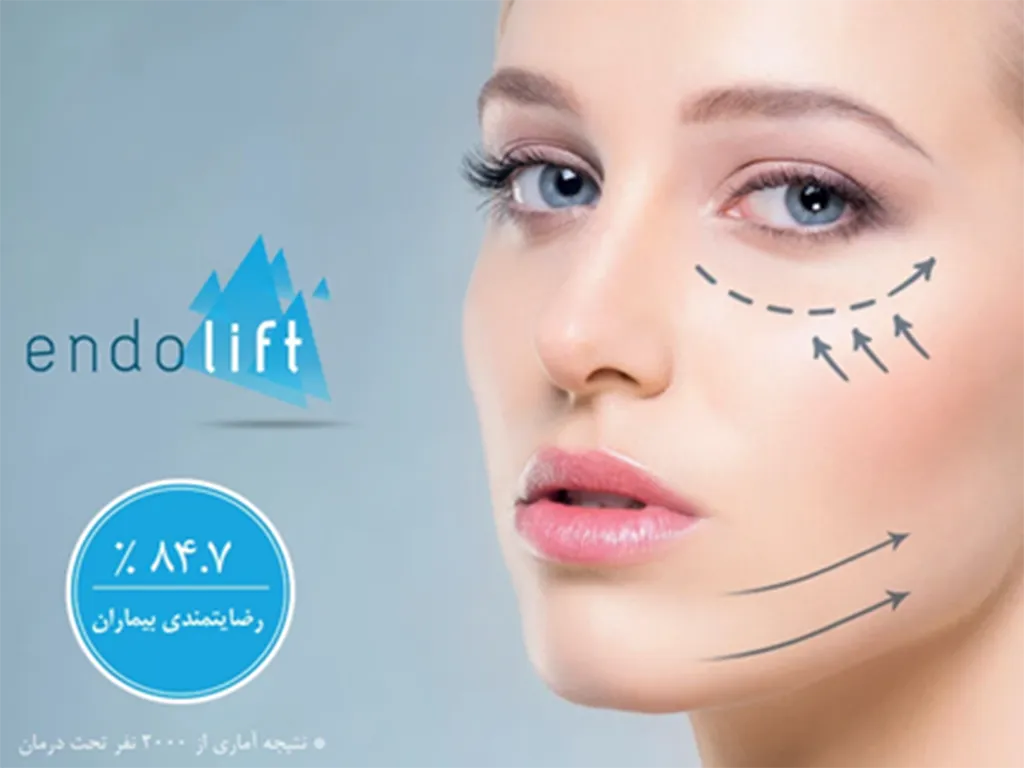 لیزر اندولیفت