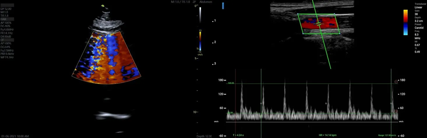 سونوگرافی پرتابل لسونو (Lesono): انقلابی در تصویربرداری پزشکی سیار 12 سونوگرافی پرتابل لسونو