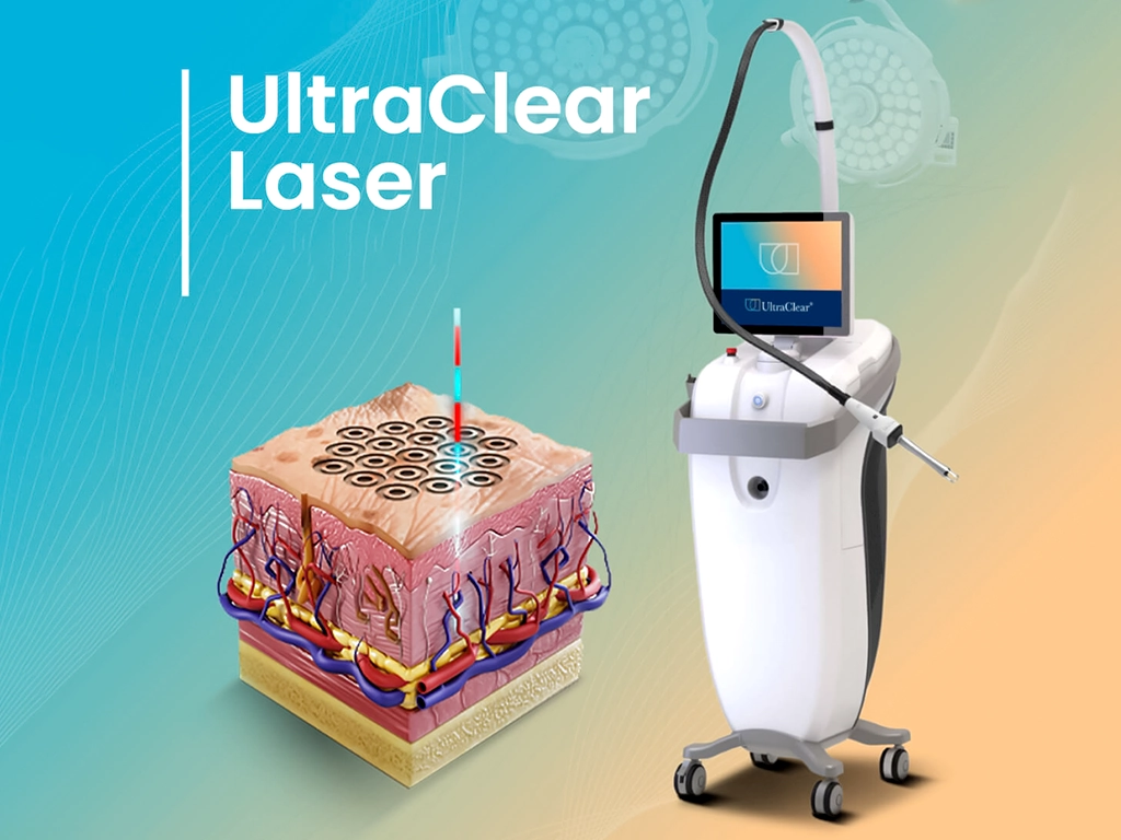 لیزر کورینگ (Laser Coring): انقلابی در جوانسازی و درمان بیماری‌های پوستی