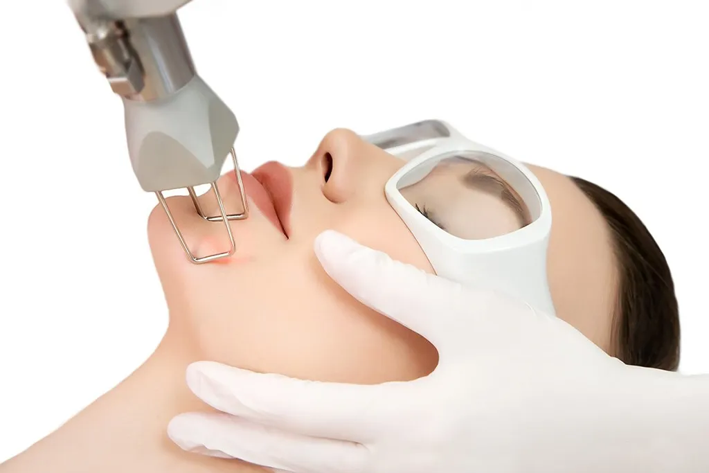 لیزر co2 فرکشنال