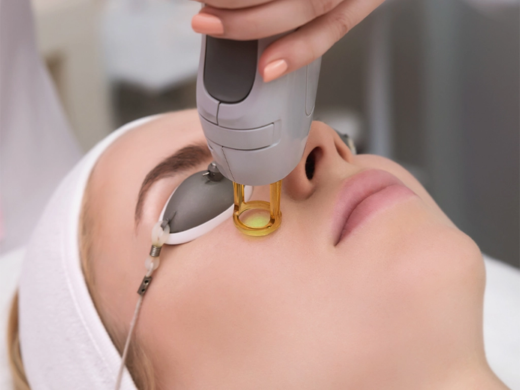 مزایای لیزر CO2 فرکشنال