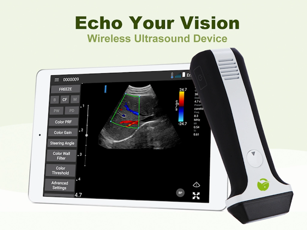 قیمت دستگاه سونوگرافی دستی: راهنمای کامل و بررسی همهجانبه 3 قیمت دستگاه سونوگرافی دستی