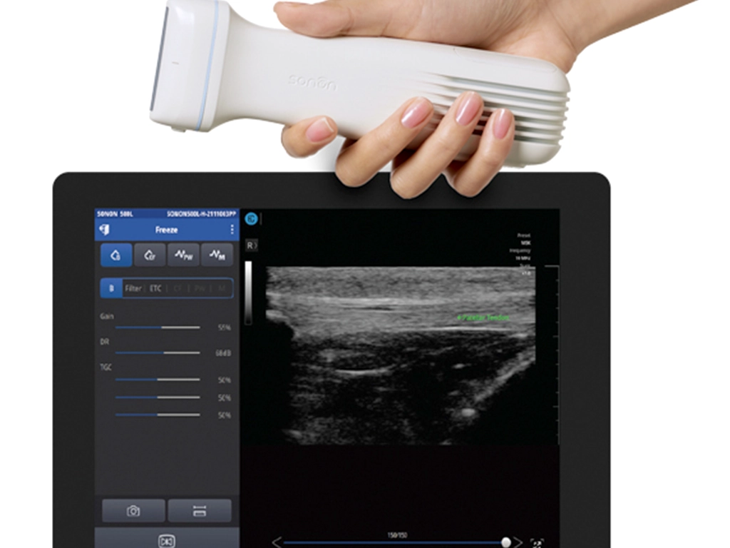 کاربردهای دستگاه سونوگرافی دستی 3 کاربردهای دستگاه سونوگرافی دستی