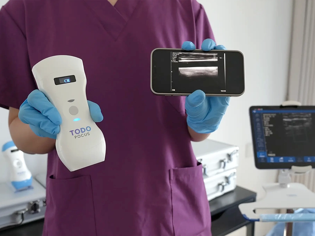 کاربردهای دستگاه سونوگرافی دستی 2 کاربردهای دستگاه سونوگرافی دستی