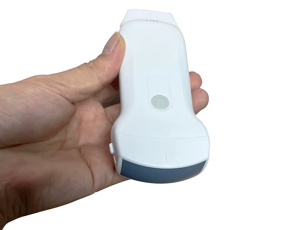 سونوگرافی دستی چیست ؟