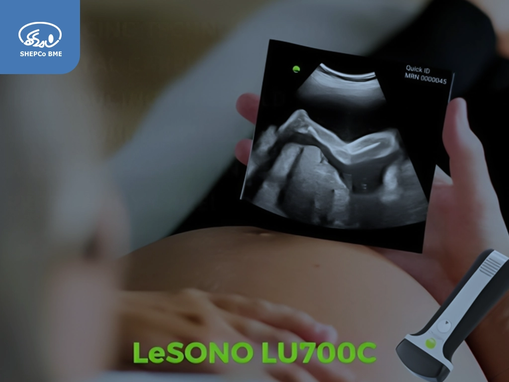 سونوگرافی دستی چیست؟