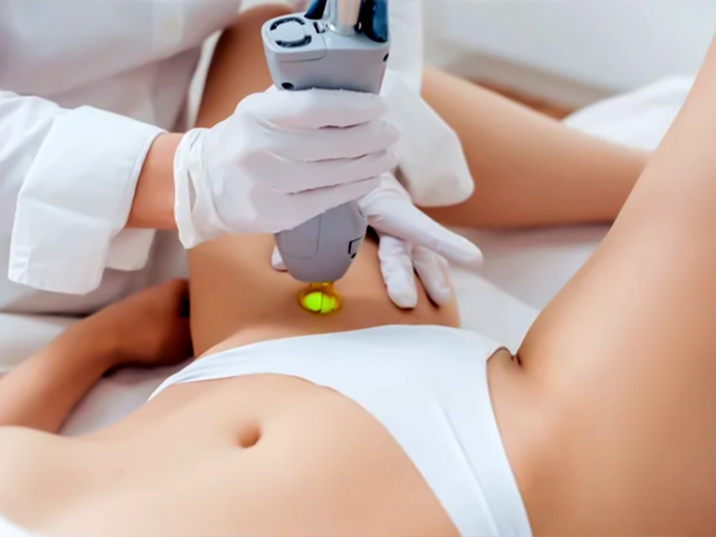 درمان تیرگی ناحیه تناسلی با لیزر؛ بررسی روش‌های ایمن