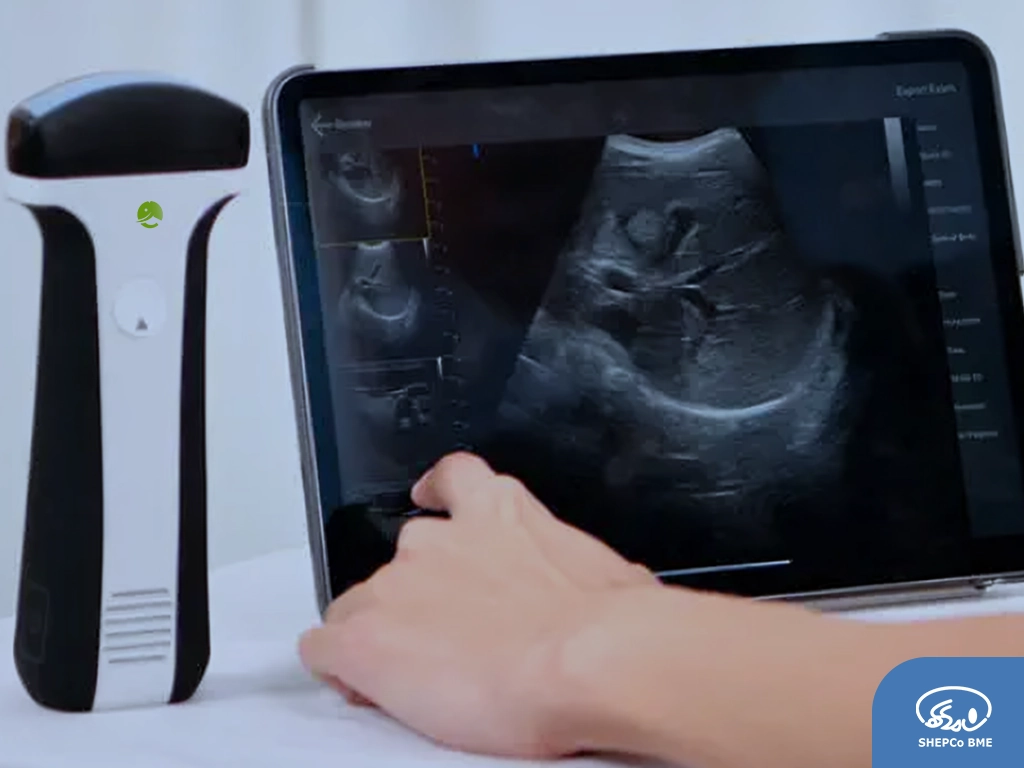 سونوگرافی پرتابل چیست؟