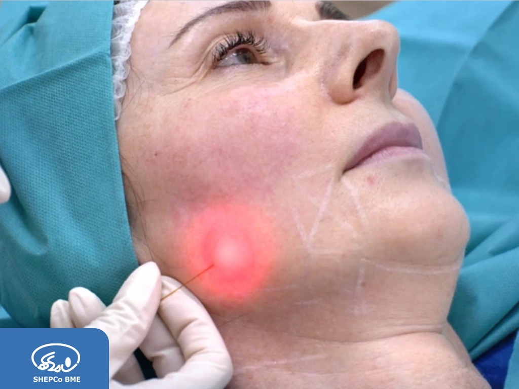 کانتورینگ صورت با اندولیفت